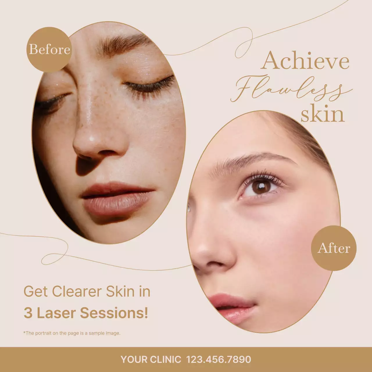 베이지 엘레강트 스킨케어 프로모션 소셜 미디어 게시물