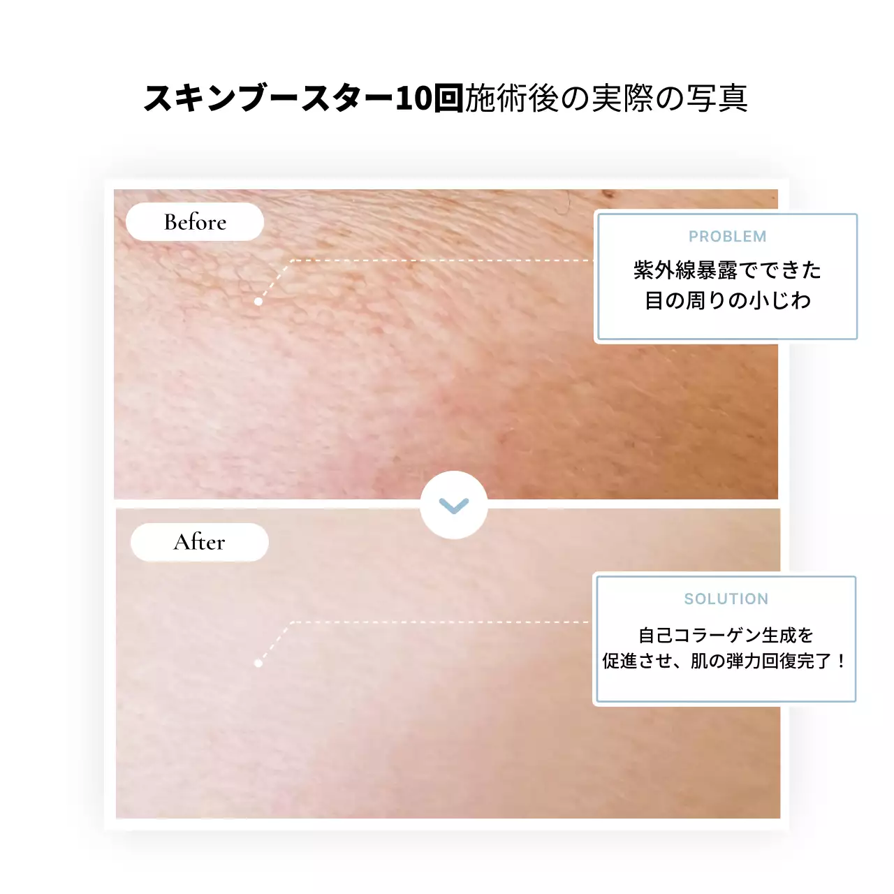 青 シンプル 美容 プラン