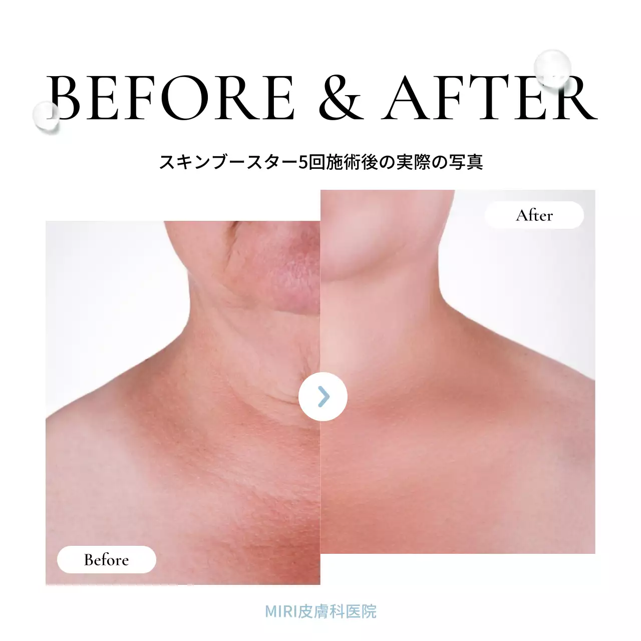 青 シンプル 美容 プラン