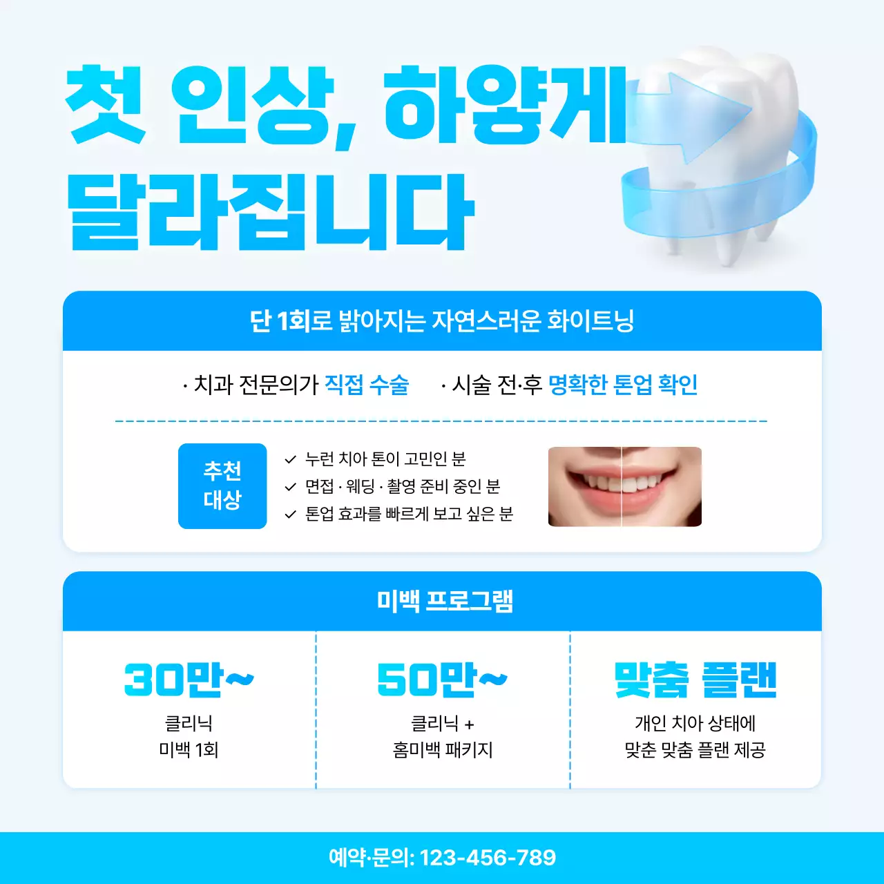 하늘색 모던 치아미백 광고