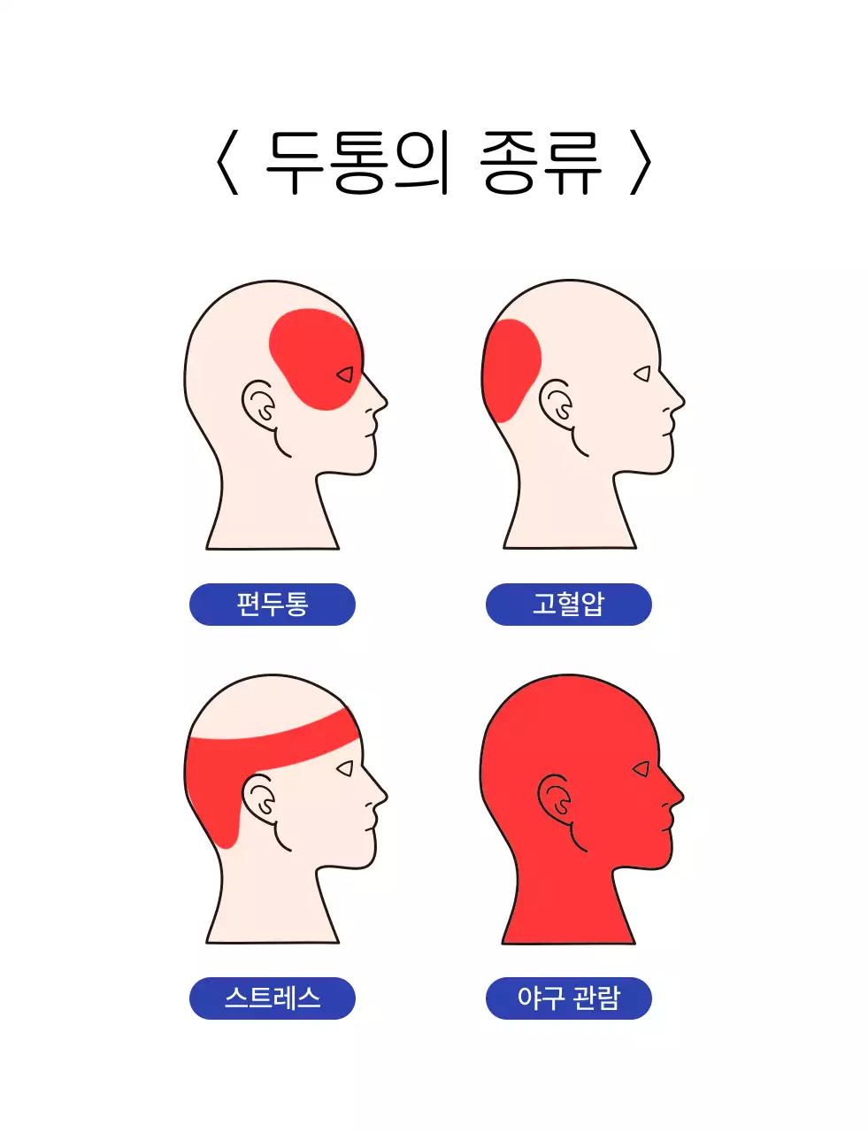 빨강 야구 두통 안내